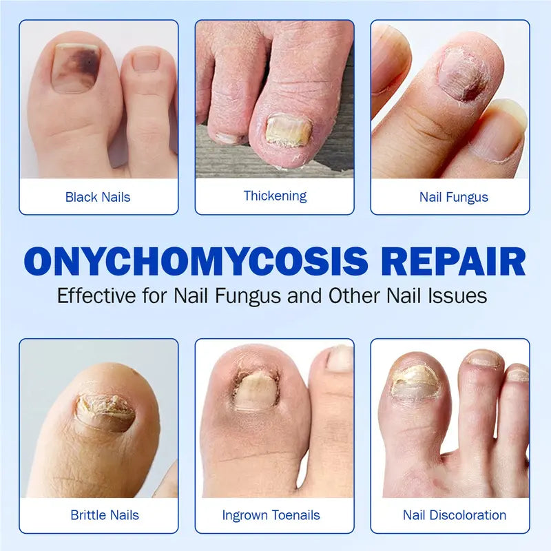 Up to 65% OFF!๐ฅNail Health Care Patches โ Repair and Strengthen Weak Nails